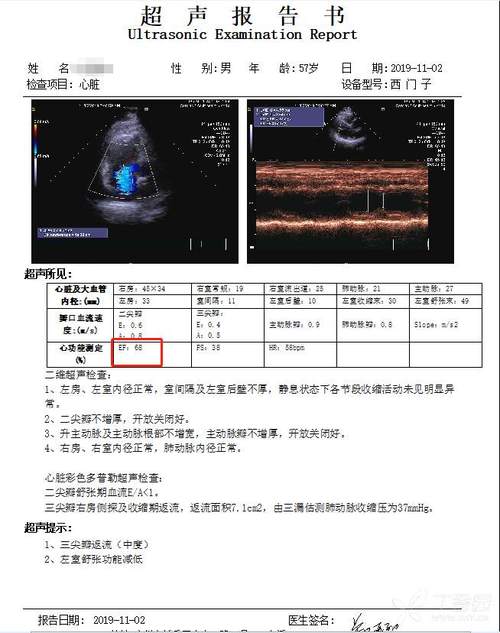ef62%正常吗:ef值67是正常的吗